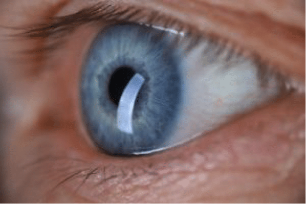 12 Síntomas del mal de ojo - Descubre cómo saber si lo tienes
