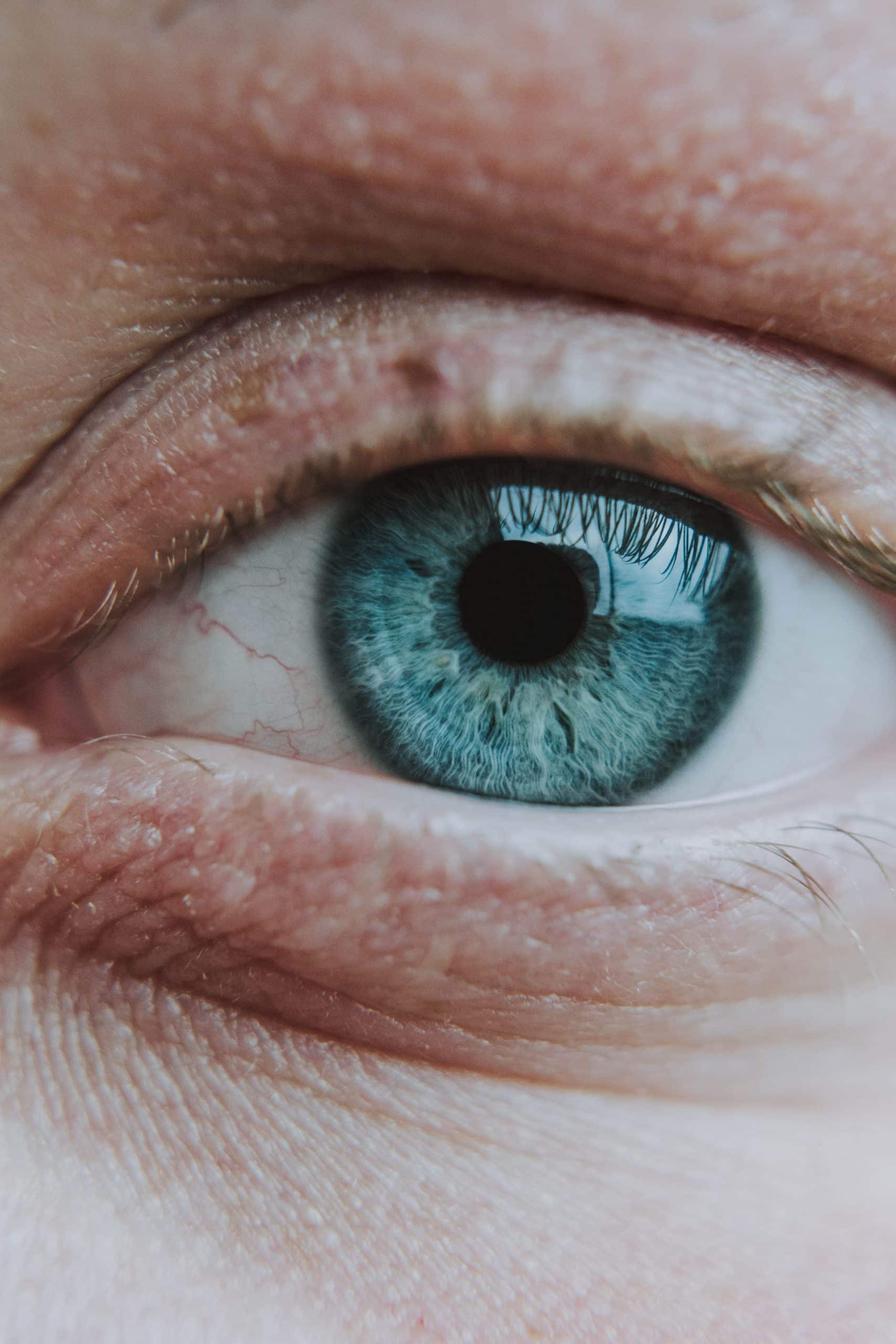 Consejos para aliviar los síntomas del ojo seco - Clínica Ojo Seco